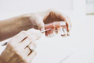 Common Concerns about Dental Consultations